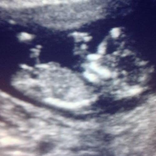 Soo exciting!!! Sonogram photo.